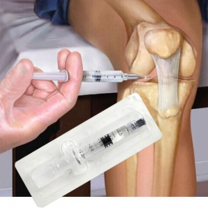 de ce toate articulațiile mâinilor doare biomecanica genunchiului